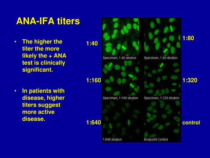 Ana autoimmune combined developing titre predict clinical conditions features children high figure